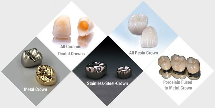 Best Dentist in Bangalore