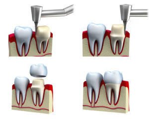 Best Dentist in Bangalore